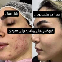 فرصت بی‌نظیر ، داشتن پوستی بی‌نقص،آموزش حرفه ای