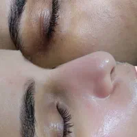 تخفیف ویژه کربوکسی تراپی