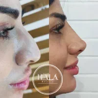 خدمات زیبایی صورت|خدمات آرایشگری و زیبایی|آبادان, |دیوار