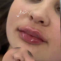 ژل لب بوتاکس فیلر بینی انزیم