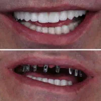 مرکز تخصصی دندانپزشکی ایمپلنت شرایط ویژه اقساطی|خدمات آرایشگری و زیبایی|تبریز, |دیوار