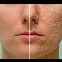 از خارش و سوزش خسته شدی