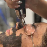 پیلینگ کربن بدن و صورت روشن سازی ریموو تتو|خدمات زیبایی و سلامت|کرج, گلشهر|دیوار