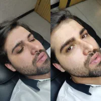 میکروبلیدینگ ابرو/رفع تیرگی لب/اسکالپ سر|خدمات آرایشگری و زیبایی|تهران, نیاوران|دیوار