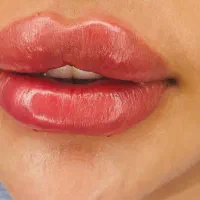 جشنواره فیلر بادی بدن باسن ممنوعه دست پا سی سی۱۸۰