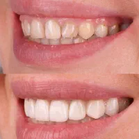 افتتاحیه دندانپزشکی قائم