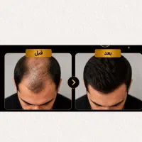 مول آب خوردن درش بیار