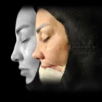 جراحی بینی به سبک مدرن ،بدون تامپون