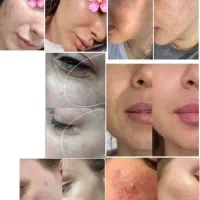 بیوممتیک لک/کک/مک جوان کننده پوست صورت