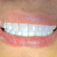 خدمات دندان پزشکی با متناسب شرایط و بودجه شما|خدمات آرایشگری و زیبایی|رودبار, |دیوار