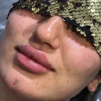 ژل و بوتاکس فرنیا بیوتی|خدمات آرایشگری و زیبایی|شهریار, شهرک وائین|دیوار