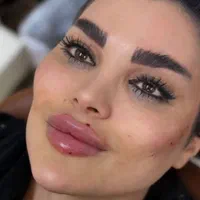 جشنواره تزریق ژل و بوتاکس/آموزش تخصصی/فشیال تخصصی|خدمات آرایشگری و زیبایی|اندیشه, اندیشه فاز ۱|دیوار