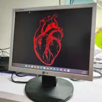 مانیتور LG Flatron L1552S