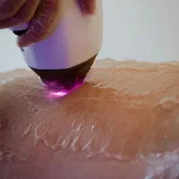 واگذاری مطب لیزر و پوست