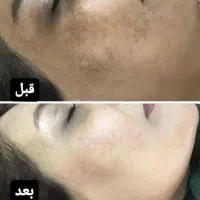 درمان بیماری پوستی