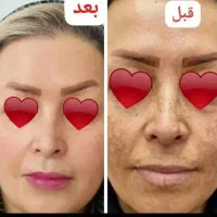 کرم VIP اماراتی معجزه صد درصد تضمینی|آرایشی، بهداشتی، درمانی|شیراز, مسلم|دیوار