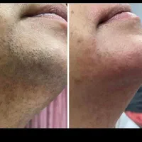لیزر تیتانیوم ۲۰۲۵ با جوابدهی تضمینی با بازگشت وجه|خدمات آرایشگری و زیبایی|شیراز, معالی‌آباد|دیوار