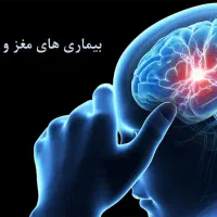 میگرن و مشکلات اعصاب