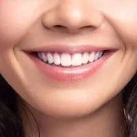 خدمات دندانپزشکی رایگان فرصت محدود زیر نظر متخصص