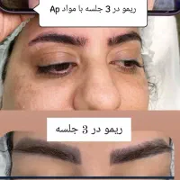 ریموو ابرو بصورت تخصصی بدون آسیب بدون درد|خدمات آرایشگری و زیبایی|بروجرد, |دیوار