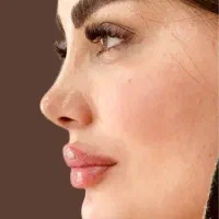 عمل بینی‌‌/ لیپو / ابدو / پیکر لیفت / اقساطی