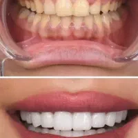 خدمات دندانپزشکی با قیمت مناسب