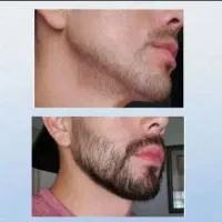 خوردنی نیست مالیدنیه