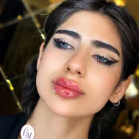 ژل بوتاکس مزوژل جشنواره ۴۹۹ت مزوژل|خدمات زیبایی و سلامت|تهران, سجاد|دیوار