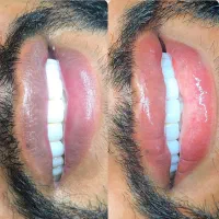 خداحافظی با تیرگی لب و تاتوی قدیمی چشم و لب|خدمات آرایشگری و زیبایی|اهواز, پادادشهر|دیوار