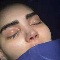 رینو پلاستی