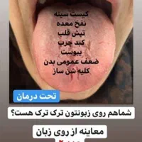 خانمای عزیز بگوش باشید|آرایشی، بهداشتی، درمانی|اصفهان, ارغوانیه|دیوار