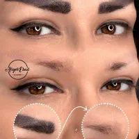 ریموو ابرو ریموسین ۱۵ دقیقه تضمینی