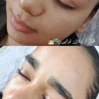 پاکسازی پوست.فیشیال تخصصی پوست