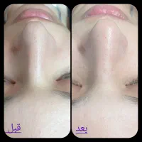 مدل پاکسازی صورت