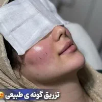 آفر آنزیم ،ژل وفیلر بادی،ساکشن ،کانتورینگ،بوتاکس|خدمات آرایشگری و زیبایی|کرج, گلشهر|دیوار