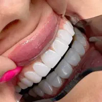 جشنواره دندانپزشکی کامپوزیت دندان از واحدی800 تومن