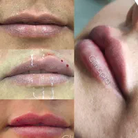 مرکززیبایی و لیزر آکو|خدمات آرایشگری و زیبایی|اندیمشک, |دیوار