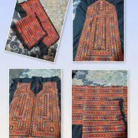 انواع دوخت پزیرفته میشه