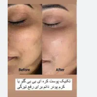 شید لب/رژلب/رفع لب تیره/مزووایت کرمپودر دایم|خدمات آرایشگری و زیبایی|اهواز, فرهنگ شهر|دیوار