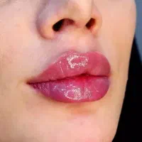 اف ویژه اموزش وخدمات ژل بوتاکس کراتین خال پوست|خدمات آرایشگری و زیبایی|دزفول, |دیوار