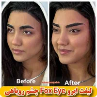 ژل آنزیم لیفت نخ عمل بینی هایفو مزو بوتاکس لاغری|خدمات آرایشگری و زیبایی|مشهد, هفت تیر (حافظ)|دیوار
