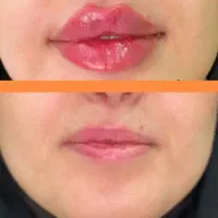 اف به مناسبت عیدقربان