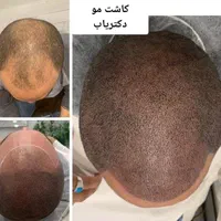 عمل های تخصصی زیبایی پوست و کاشت مو و ابرو دکتریاب