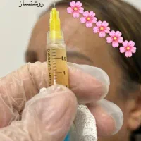 خدمات پی آرپی پوست با ۲۰درصد تخففیف یلدایی تا ۱۰دی