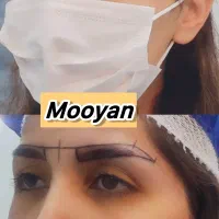 کاشت مو ۲۲ و کاشت ابرو ۱۵