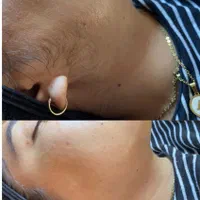 کلینیک لیزر موهای زائد|خدمات آرایشگری و زیبایی|خمینیشهر, |دیوار