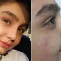 جشنواره تخفیف عمل زیبایی بینی|خدمات آرایشگری و زیبایی|قائم‌شهر, |دیوار