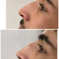 اصلاح فرم|خدمات آرایشگری و زیبایی|سنندج, |دیوار