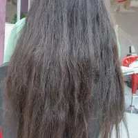 تخفیف ویژه موخوره گیری