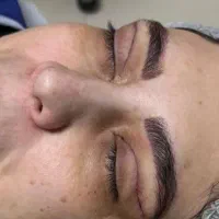 بلفاروپلاستی،لیفت ابرو،لیفت شقیقه،دایرکت ابرو|خدمات آرایشگری و زیبایی|ارومیه, |دیوار